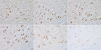 Антитела Anti-Mouse IgG (H+L) ослиные, поликлональные, конъюгированные с HRP, иммуногистохимический анализ