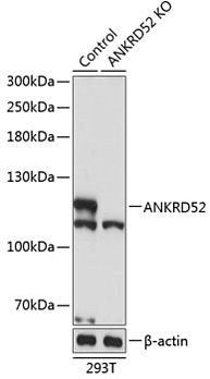 Антитела [KO Validated] ANKRD52 кроличьи, поликлональные