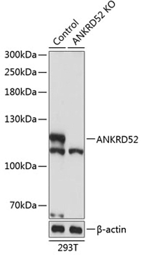 Антитела [KO Validated] ANKRD52 кроличьи, поликлональные